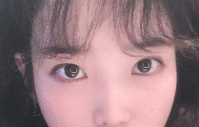 아이유