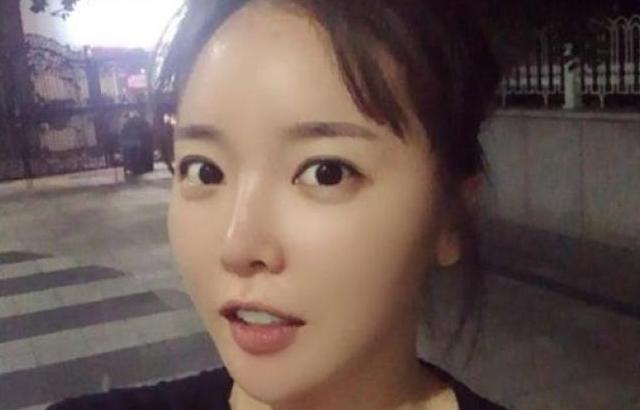 홍진영 생얼